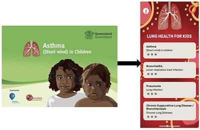 Multi-lingual “Asthma APP” improves health knowledge of asthma among Australian First Nations carers of children with asthma